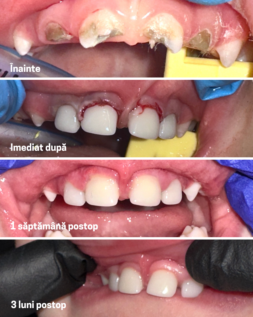 Evoluția tratamentului