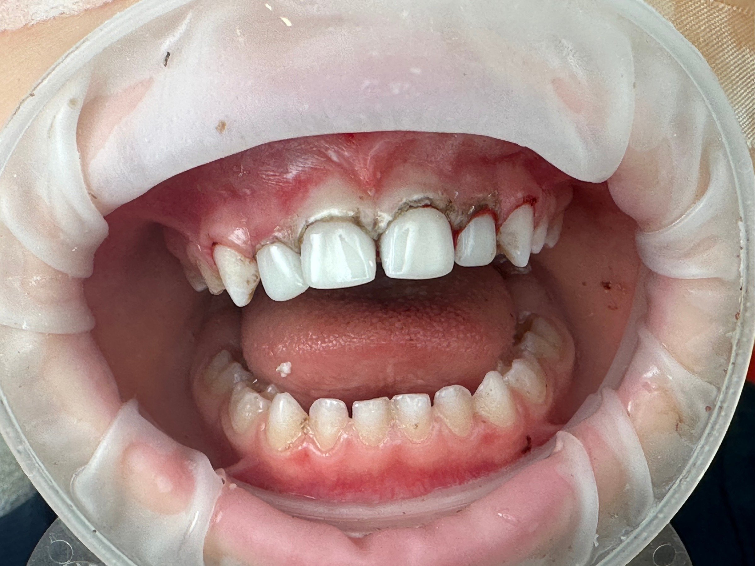 Rezultat stomatologic pediatric